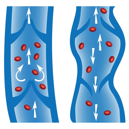 angiologie gefässkrankheiten venen